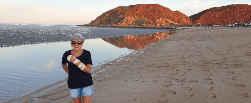 Woman standing on beach with arm in cast